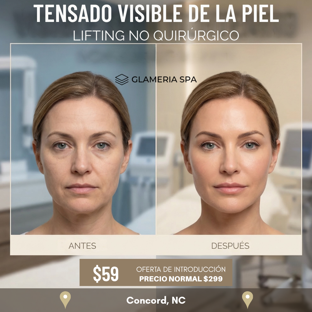 Forever Young Facebook ad: Lifting Personalizado de Rostro y Cuello, Solo $59