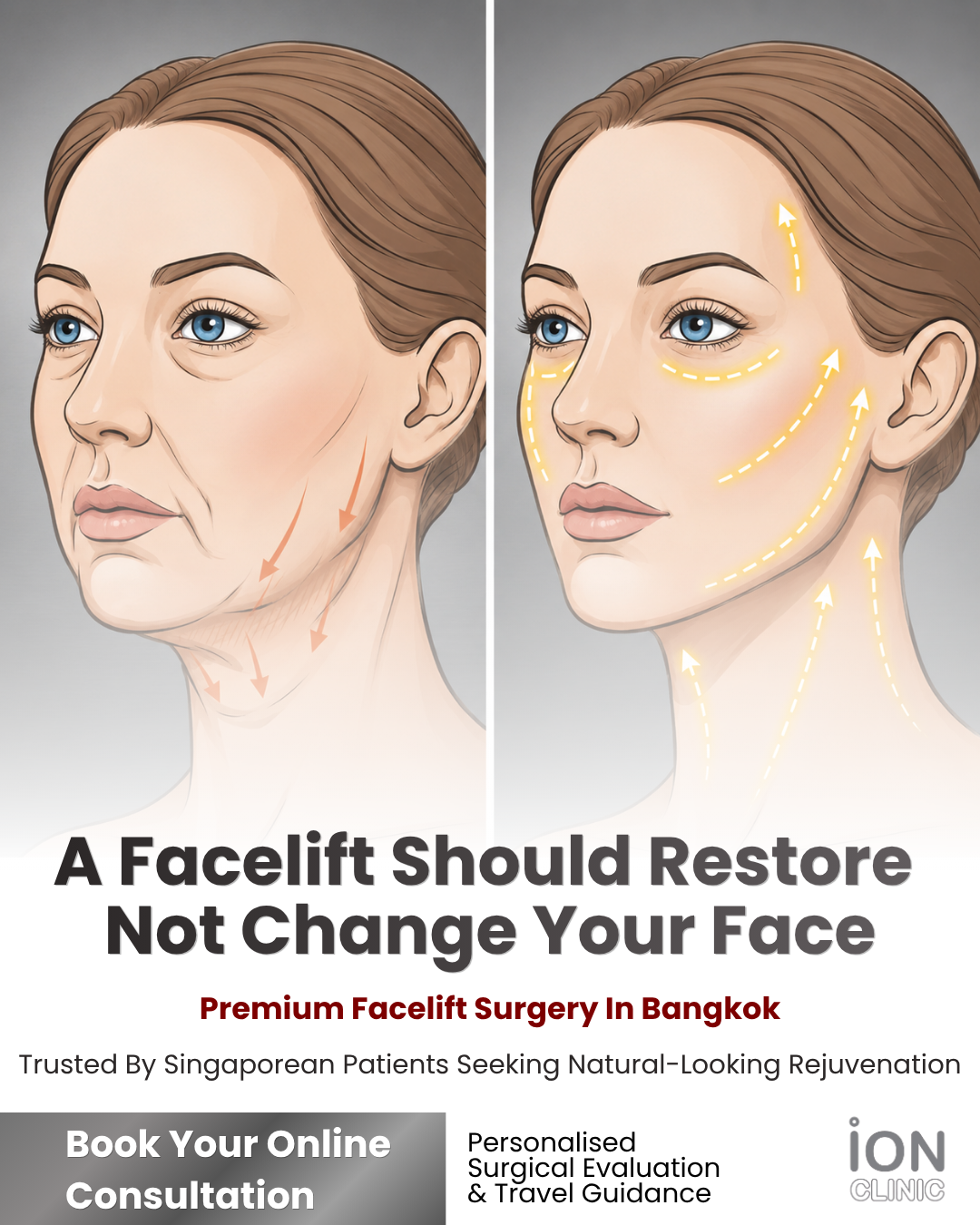 ION Clinic Bangkok Facebook ad