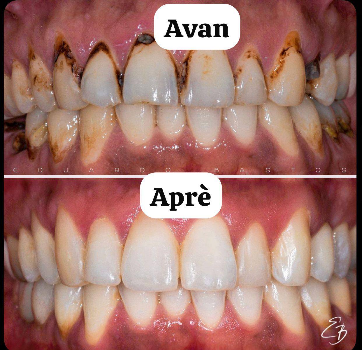 Clinique expert dent Facebook ad: Konsiltasyon GRATIS