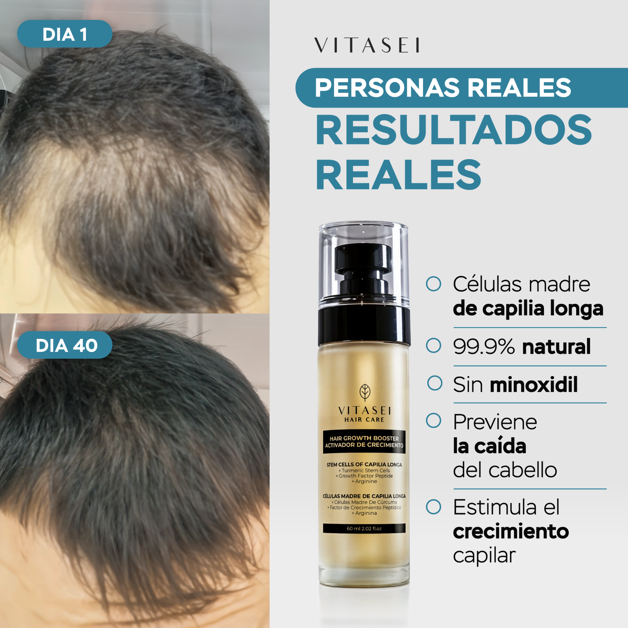 Vitasei Oficial Facebook ad from Jul 8, 2025