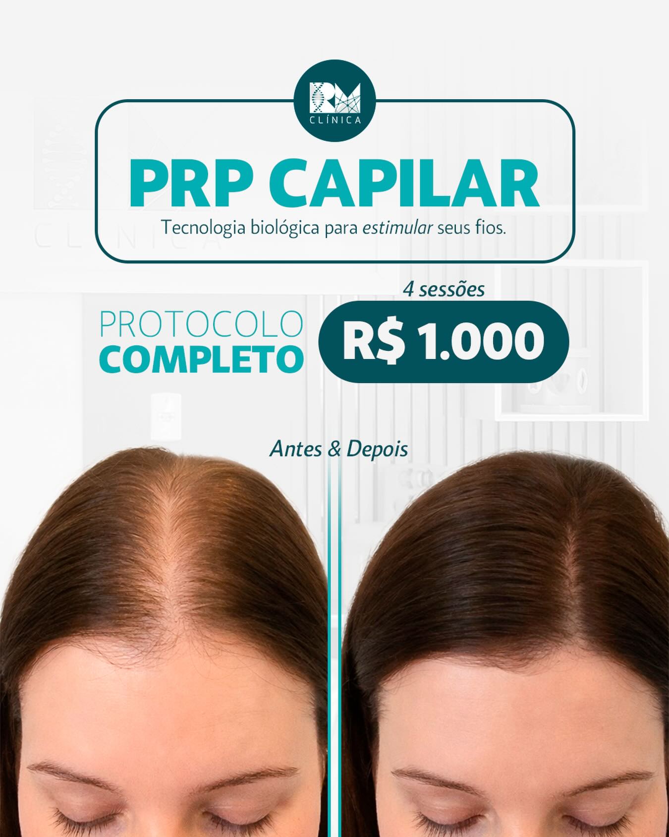 Rm Clinica Tocantins Facebook ad: Tratamento moderno, minimamente invasivo e com base…