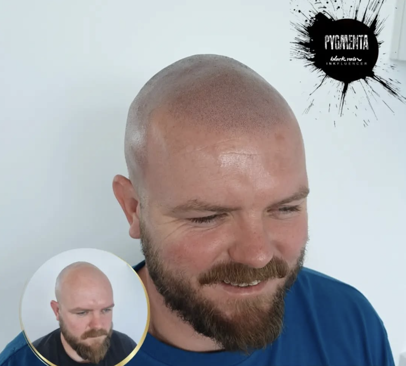 Pro Micro Facebook ad