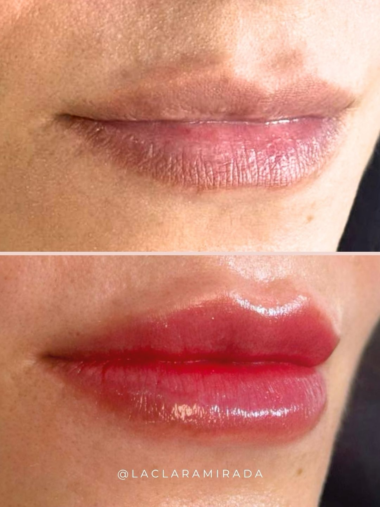 La Clara Mirada Facebook ad: Un antes y después que habla por sí…