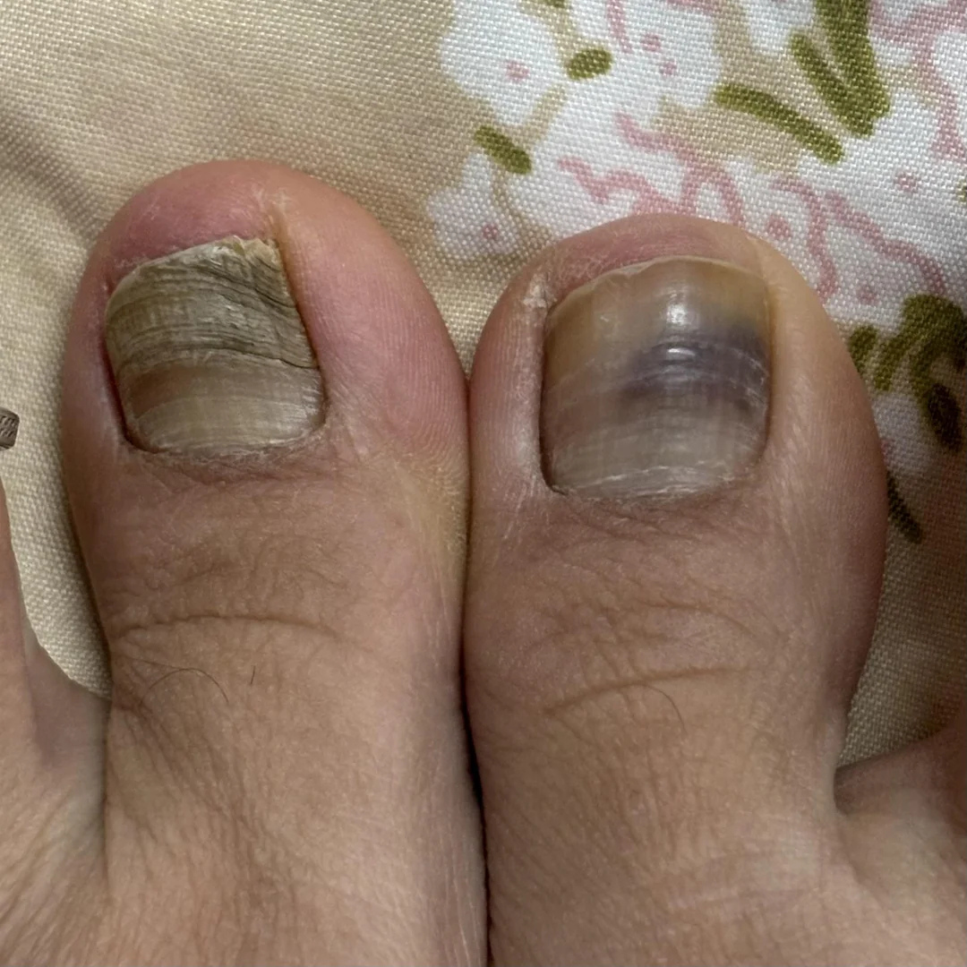 Dr. Jenna Blake, Podiatrist Facebook ad
