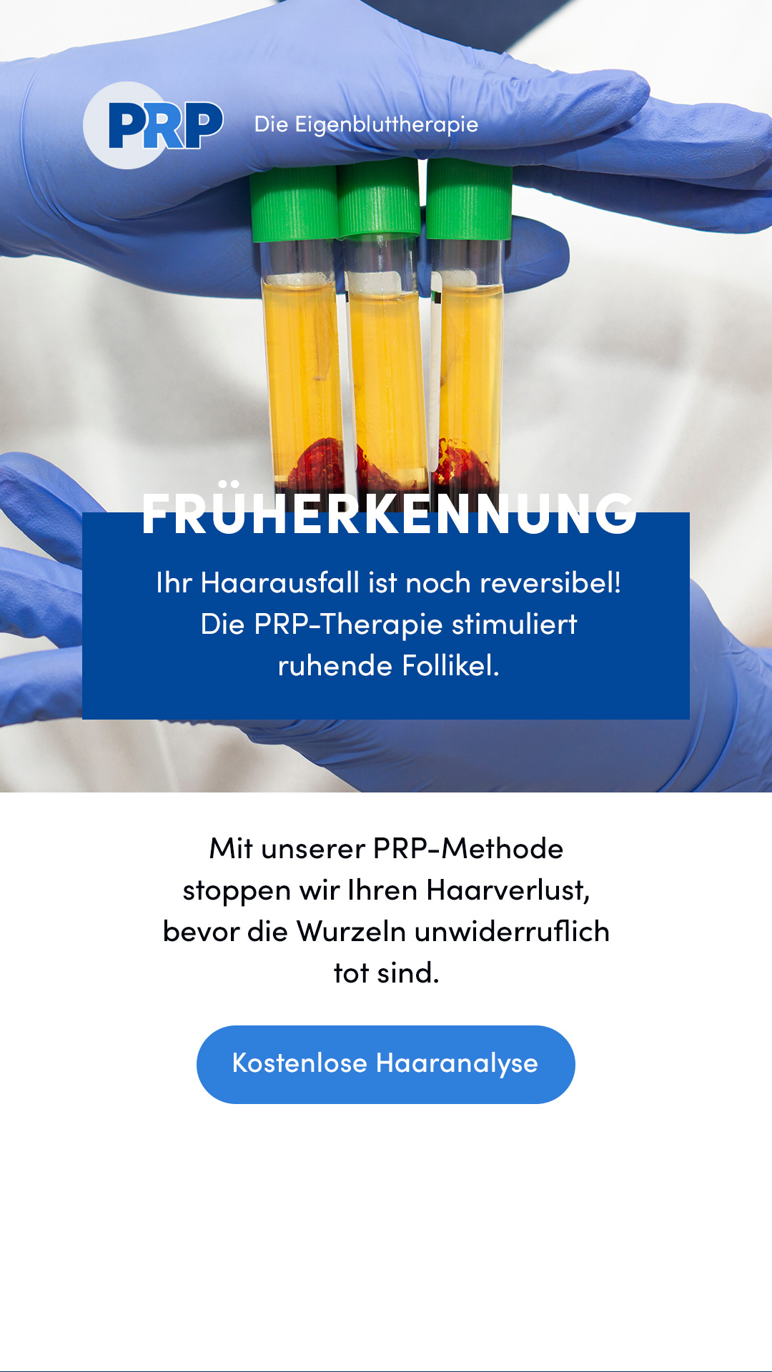 PRP Behandlung Facebook ad