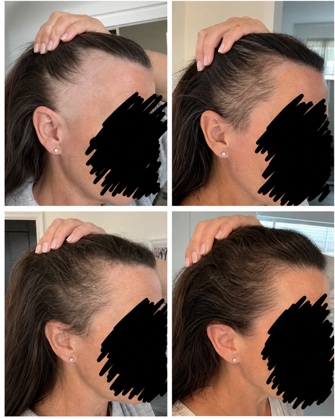 Amina Mitchell Facebook ad: Stop GLP-1 Hair Loss →