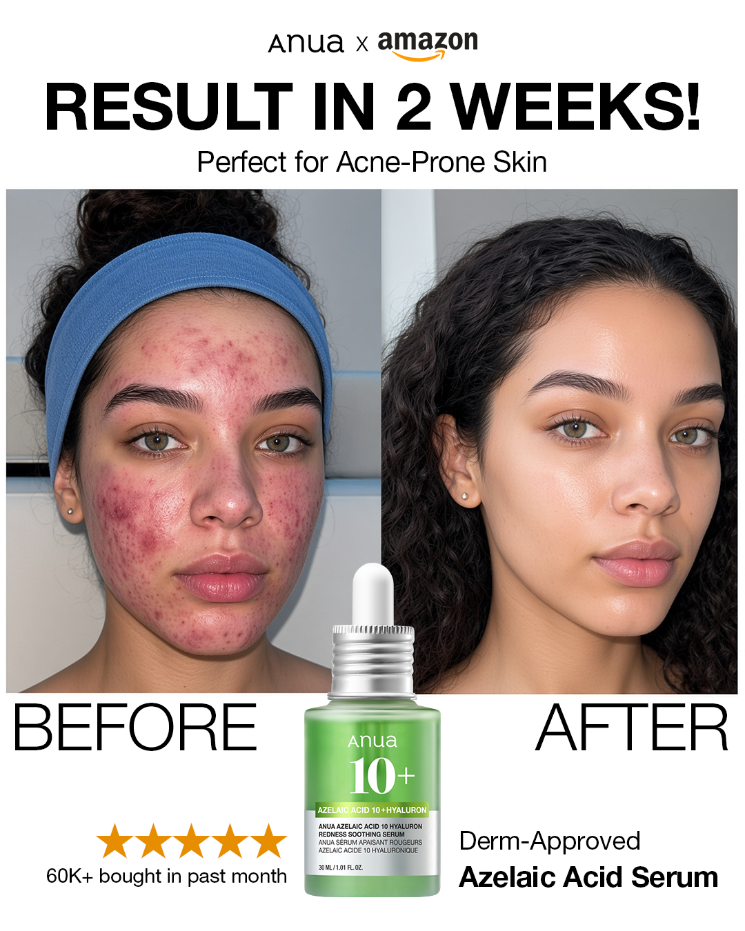 ANUA_Global Facebook ad