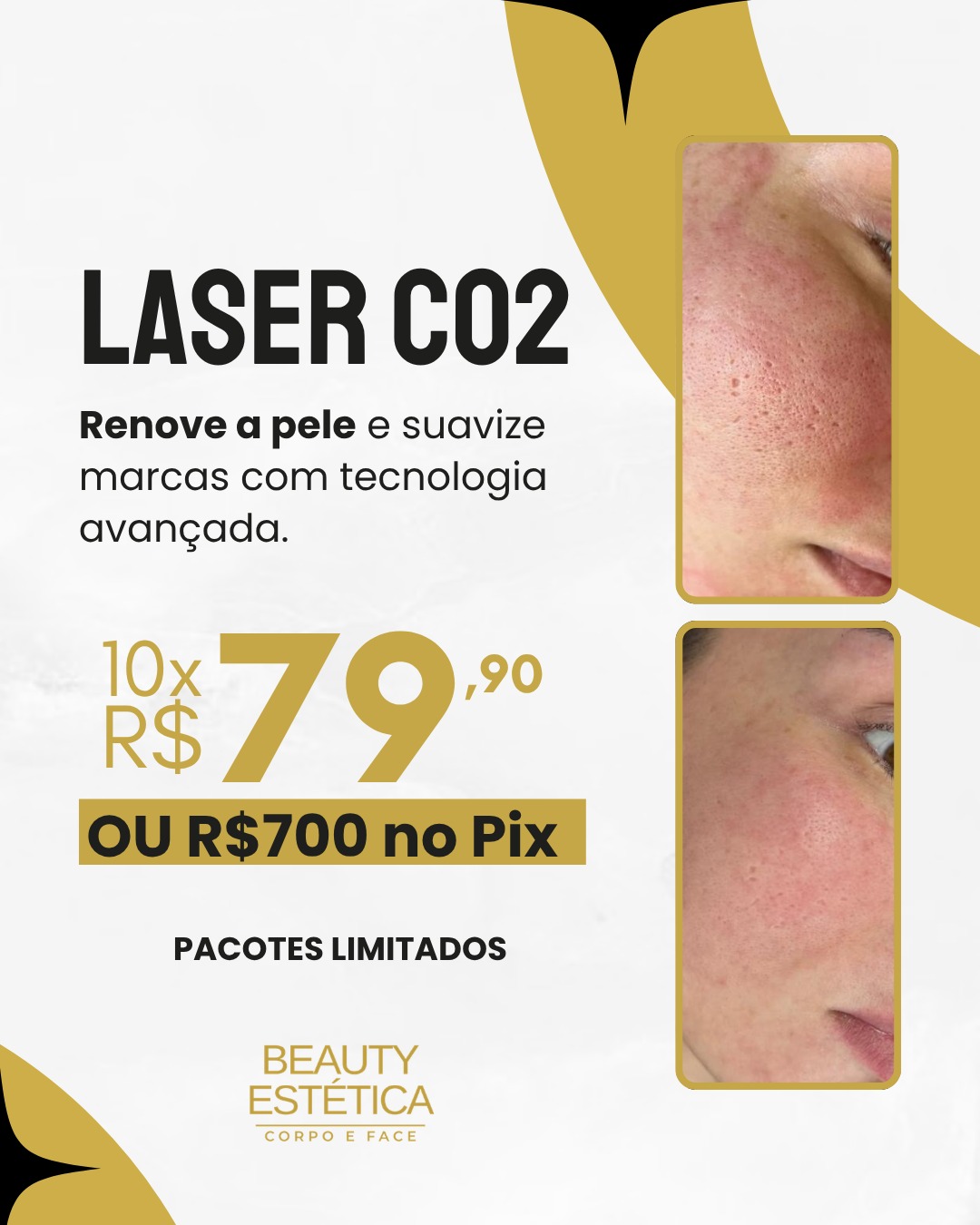 Beauty Estética Corpo e Face Facebook ad: Agende Aqui sua Avaliação