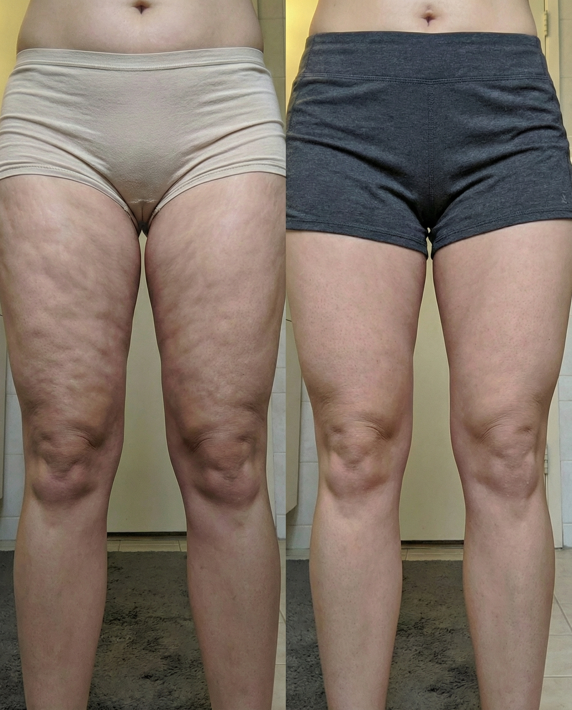 Daily Body Health Facebook ad