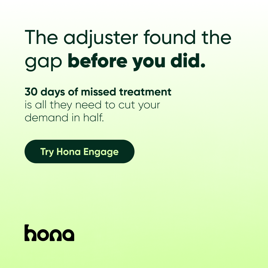 Hona Facebook ad
