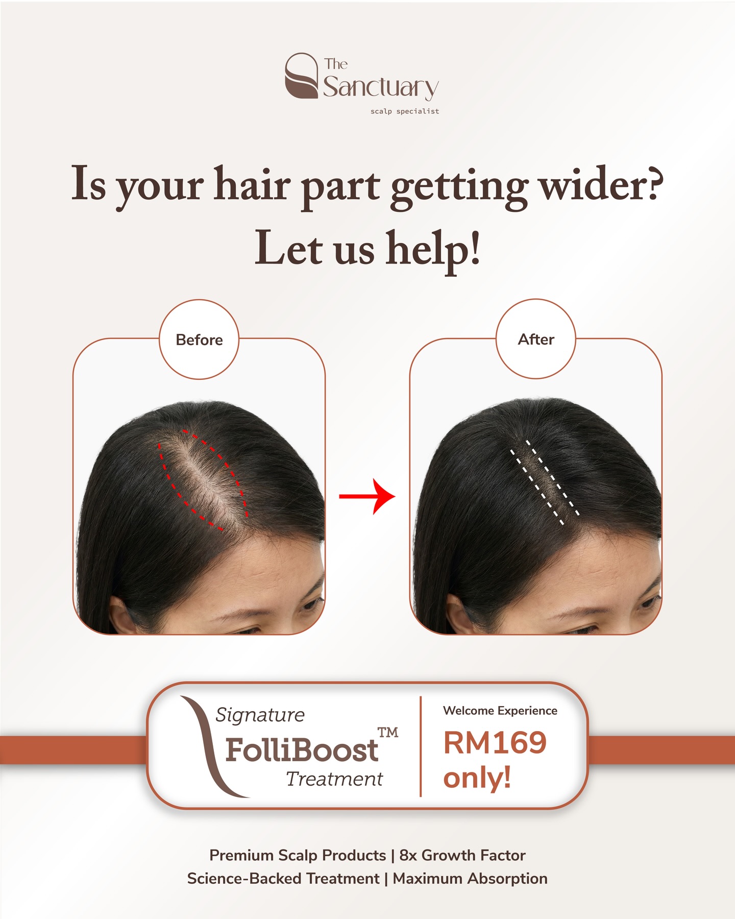 The Sanctuary Scalp Care Centre Facebook ad
