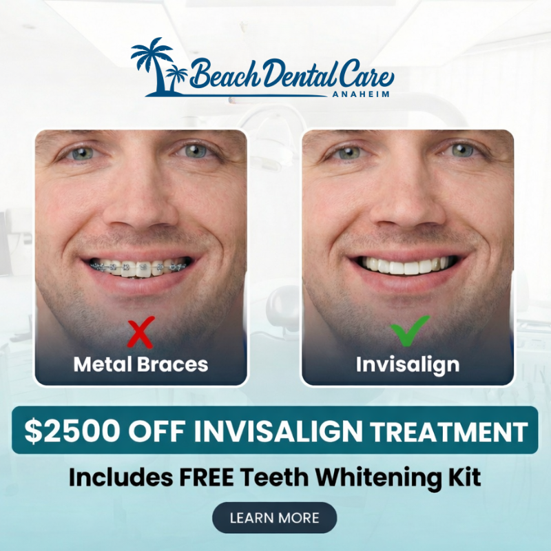 Beach Dental Care Anaheim Facebook ad from Apr 9, 2026