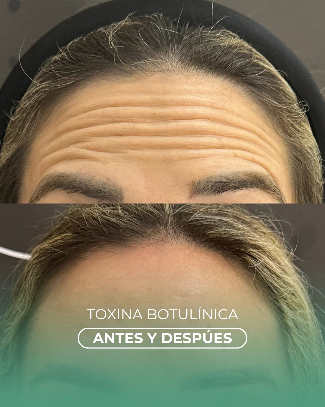 Dra. Nadia Jabif Facebook ad: Hablemos del BOTOX