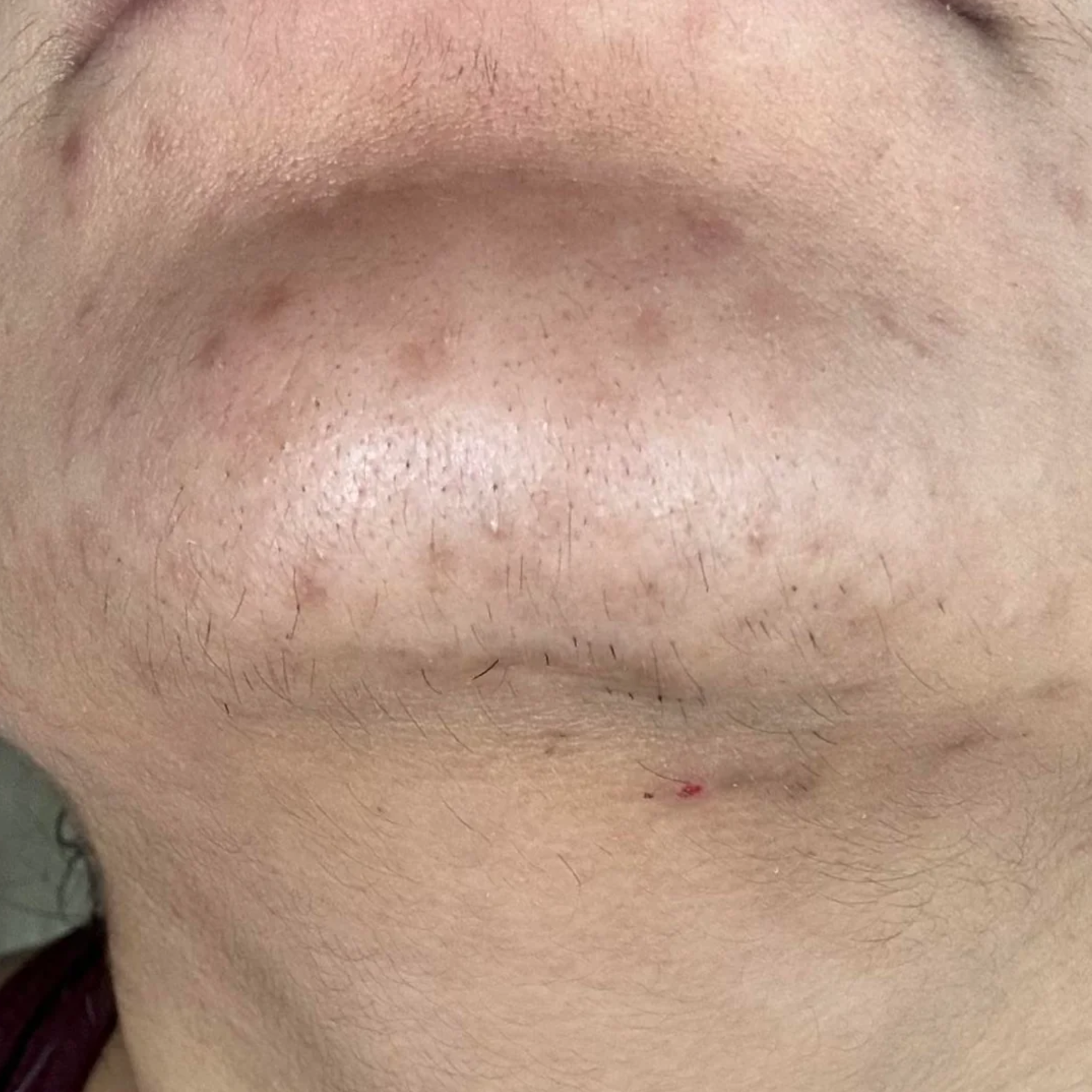 Chantal Dupont Facebook ad: Lis ceci si tu as des poils sur le visage