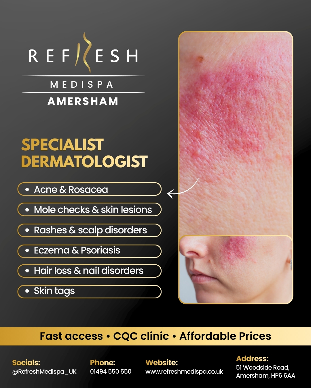 Refresh Medispa Amersham Facebook ad: See our Dermatology Specialist Fast
