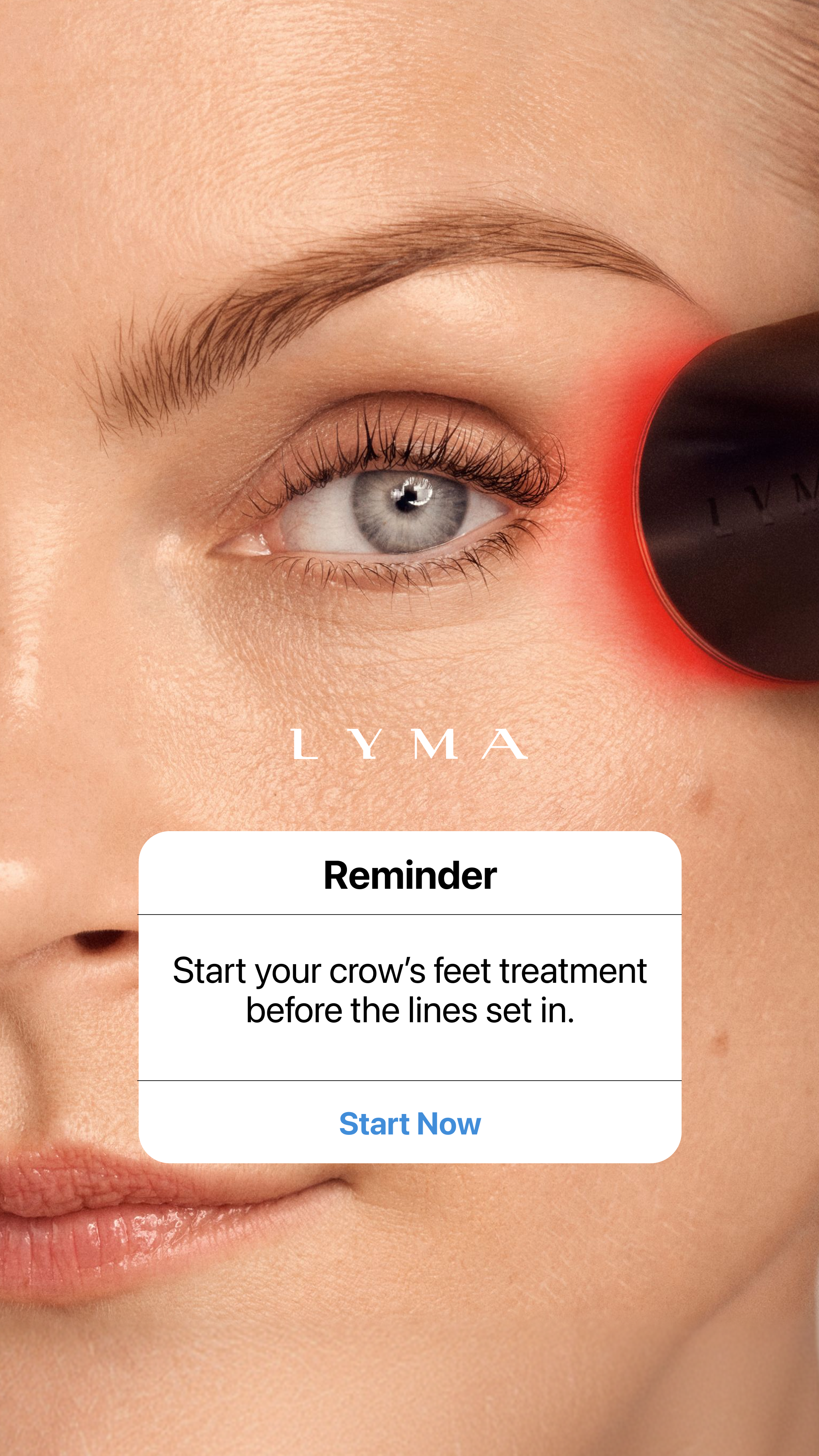 LYMA Facebook ad