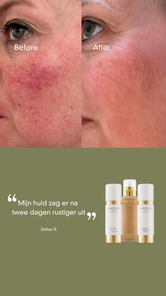 ABLOOM Slow Skincare Facebook ad