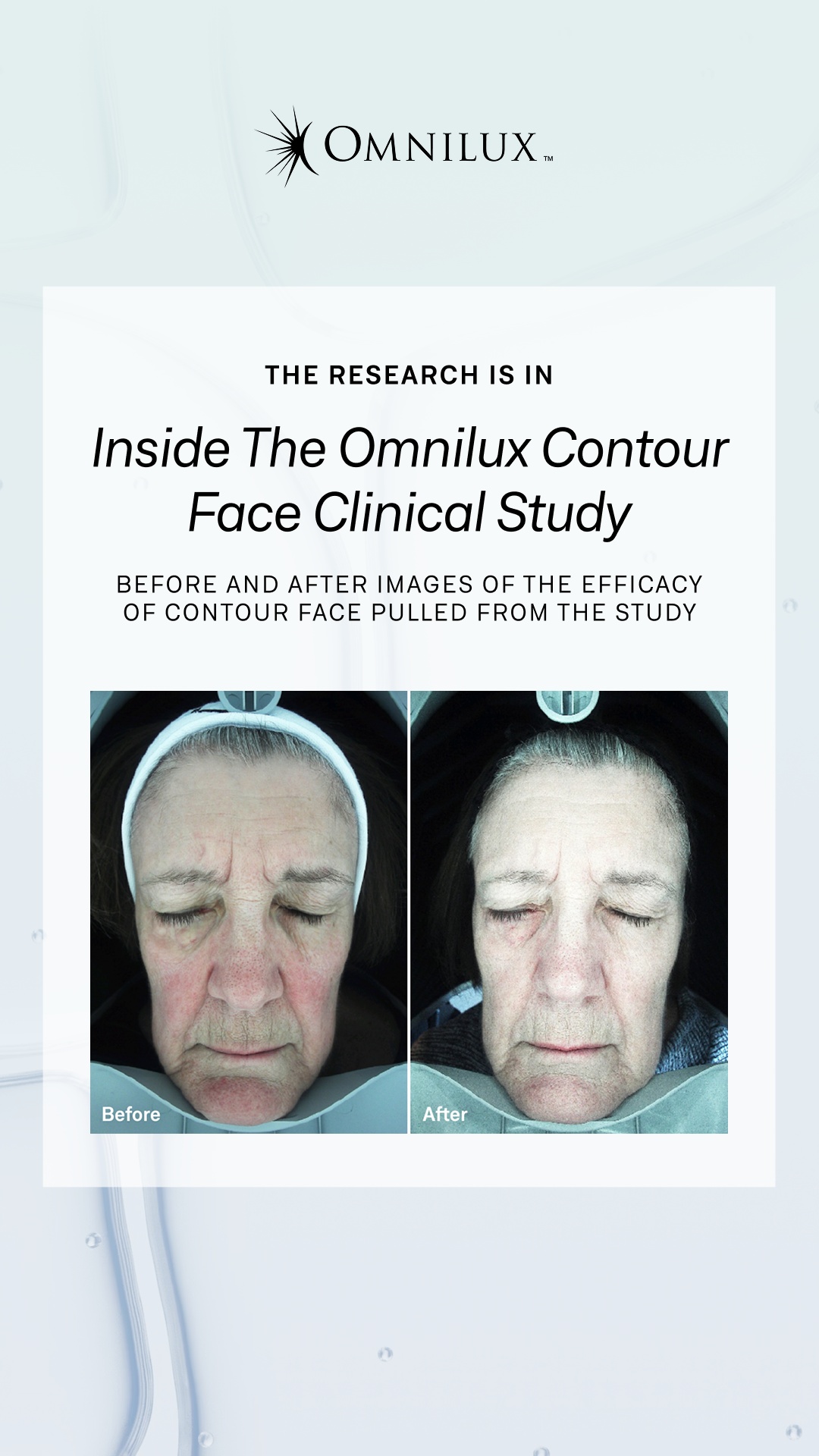 Omnilux Facebook ad
