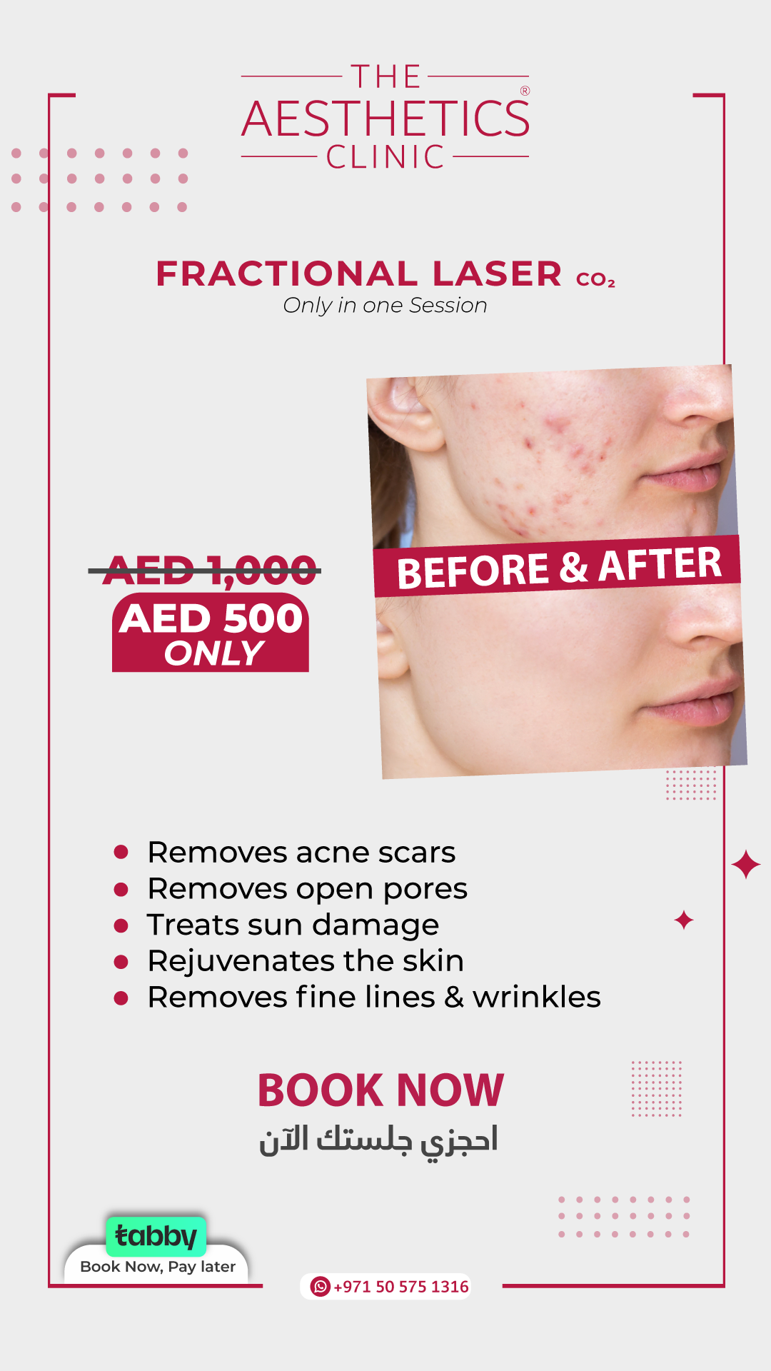 The Aesthetics Clinic Facebook ad