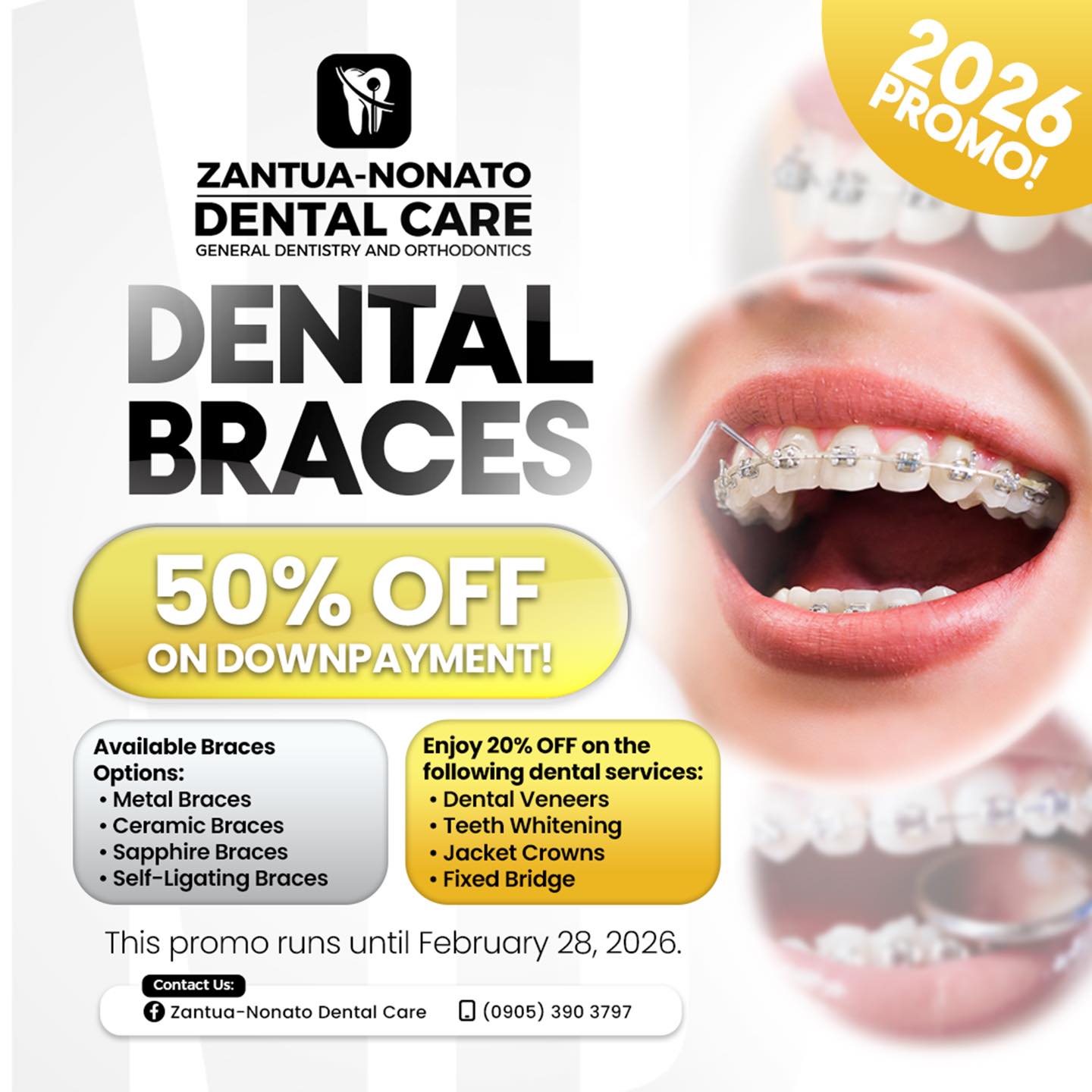 Zantua-Nonato Dental Care Nabua Branch Facebook ad