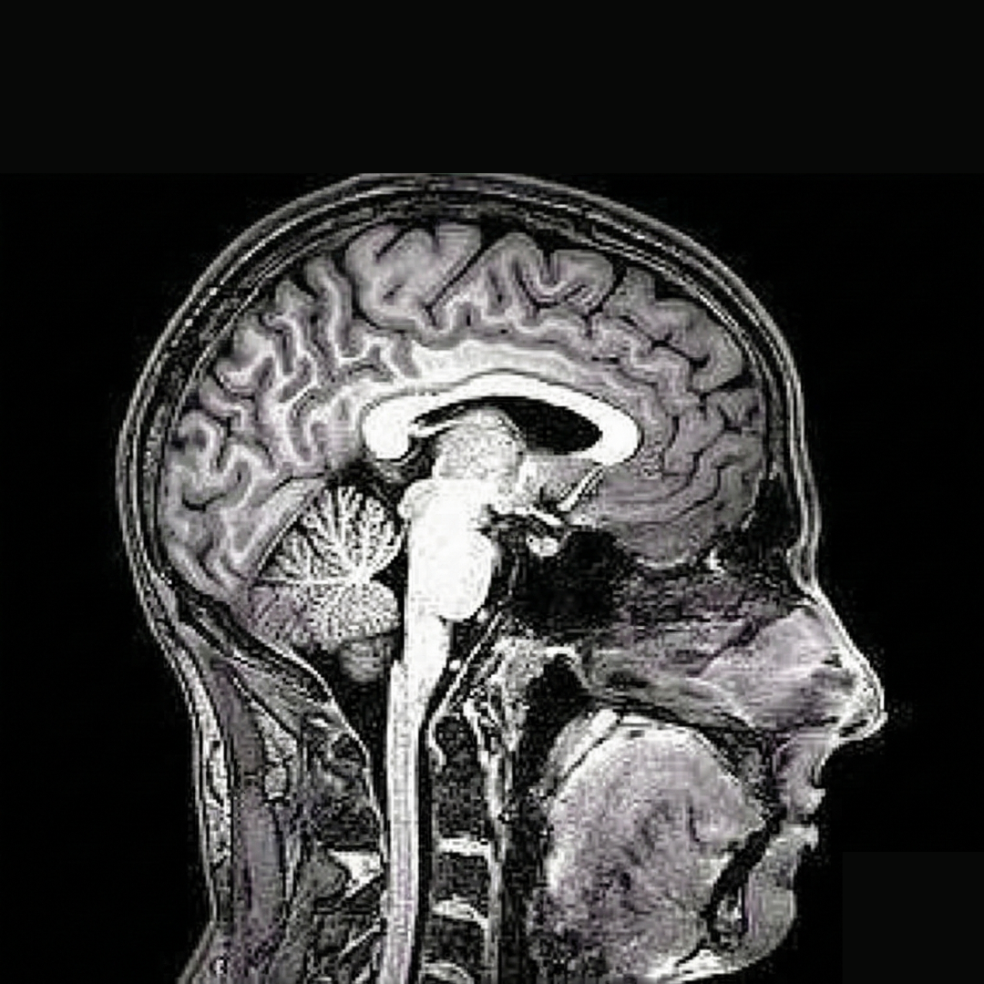 Healthy Brain Insider Facebook ad