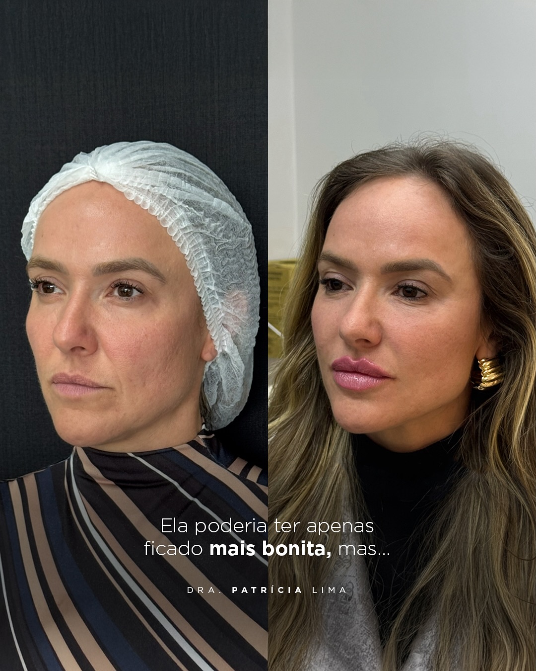 Dra. Patricia Lima Facebook ad: Uma mulher quando posiciona melhor sua face, ela…
