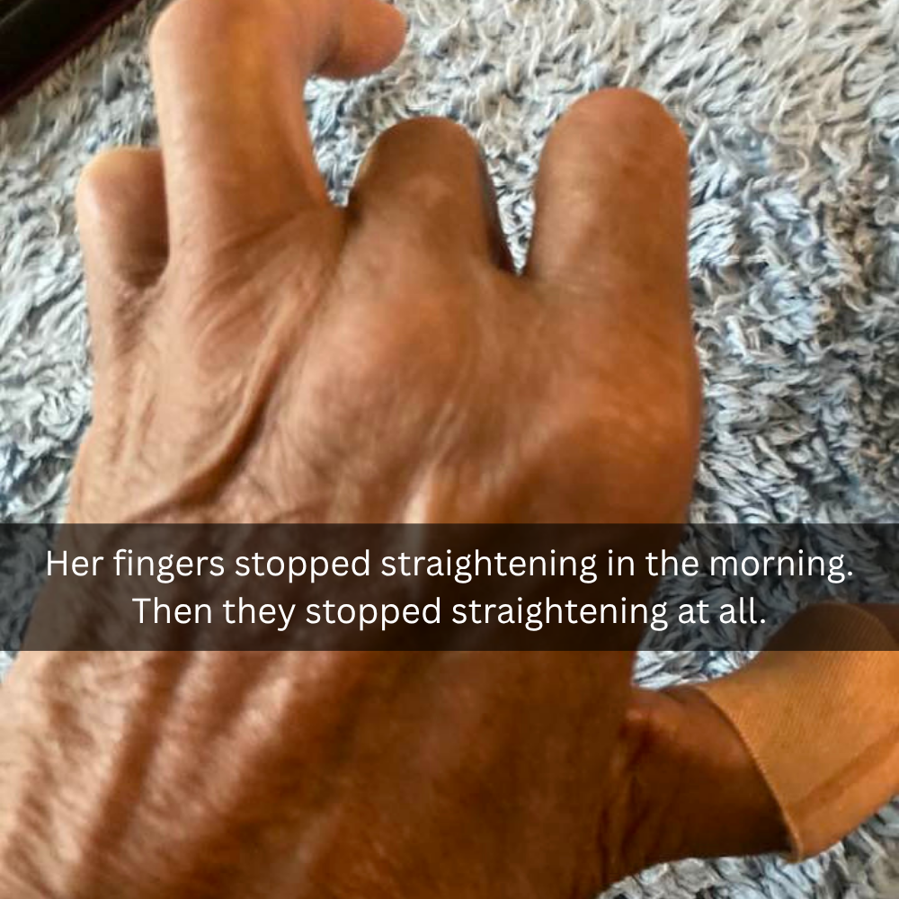 The Menopause Journal Facebook ad: Menopause did this to her hands