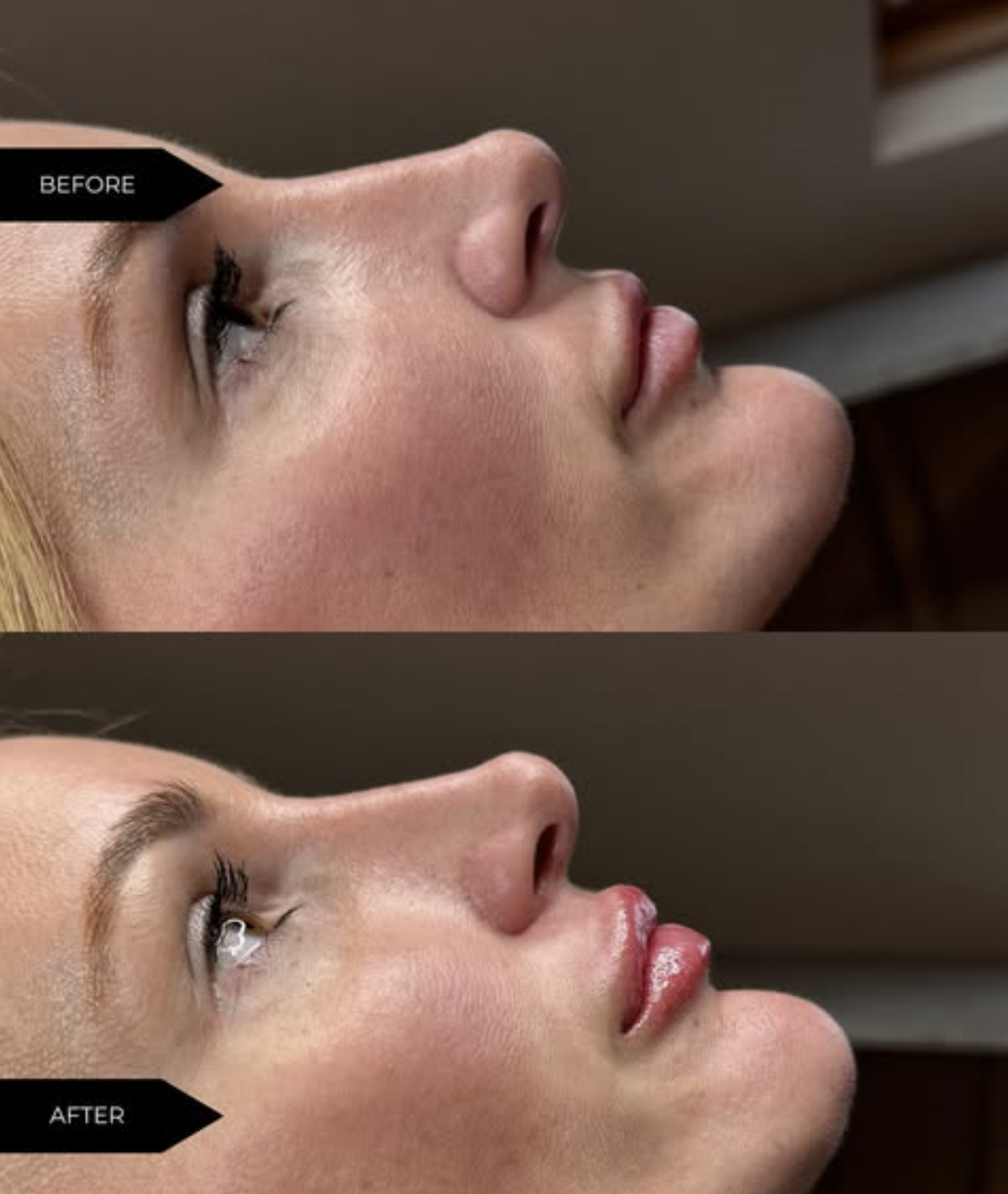 Scratch Aesthetics Facebook ad
