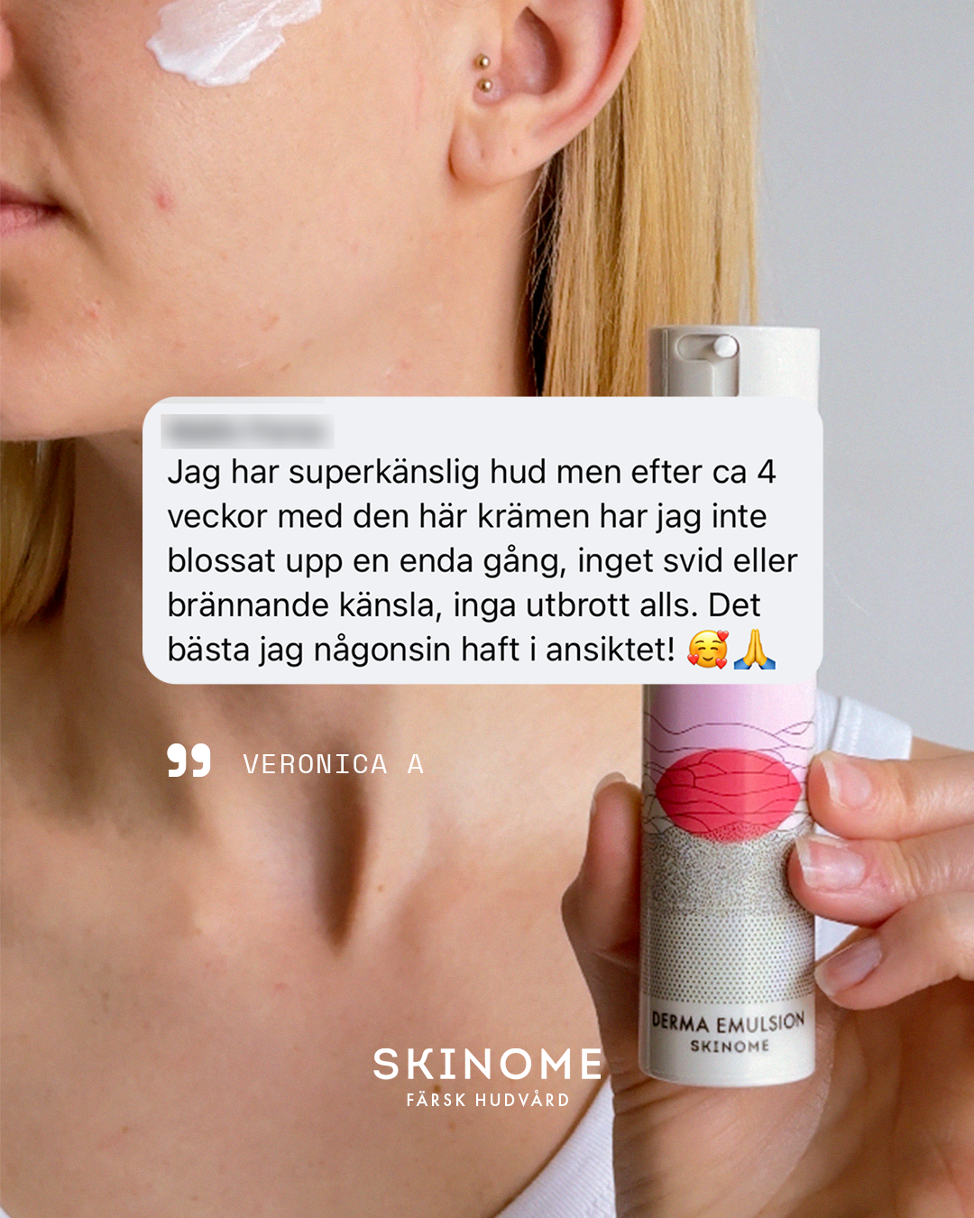 Skinome Facebook ad