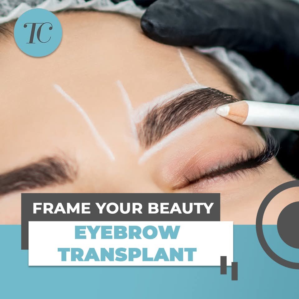 Tajmeel Clinic Facebook ad: Hair Transplant, hair loss treatment and Aesthetics Clinic…