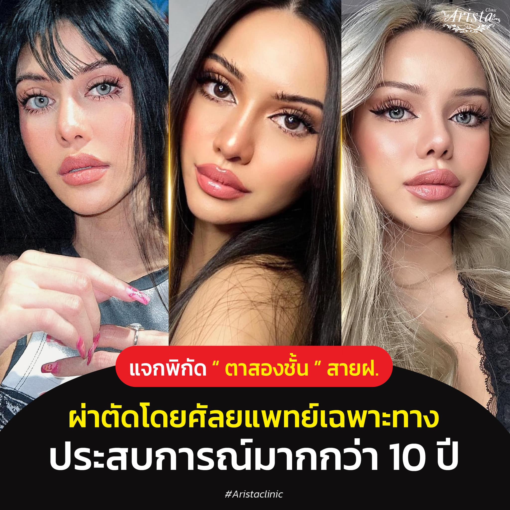Arista clinic Facebook ad: ตาสองชั้น สวยตลอดกาล.สวยเปลี่ยนตั้งแต่หลังทำ