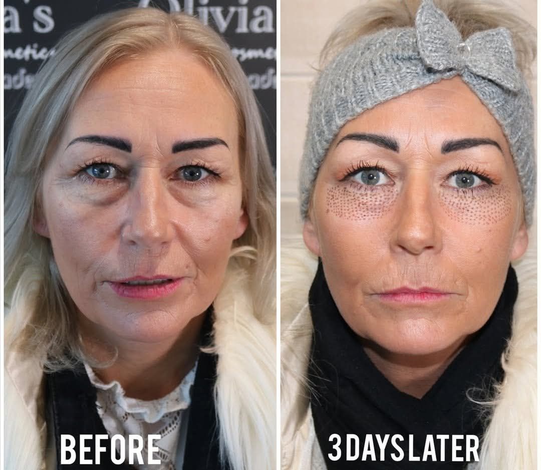 Plasma Aesthetics North-West & Skin Care Clinic Facebook ad: CLIENT SELFIE ALERT