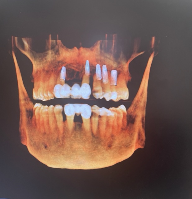 The Dental Equation Facebook ad