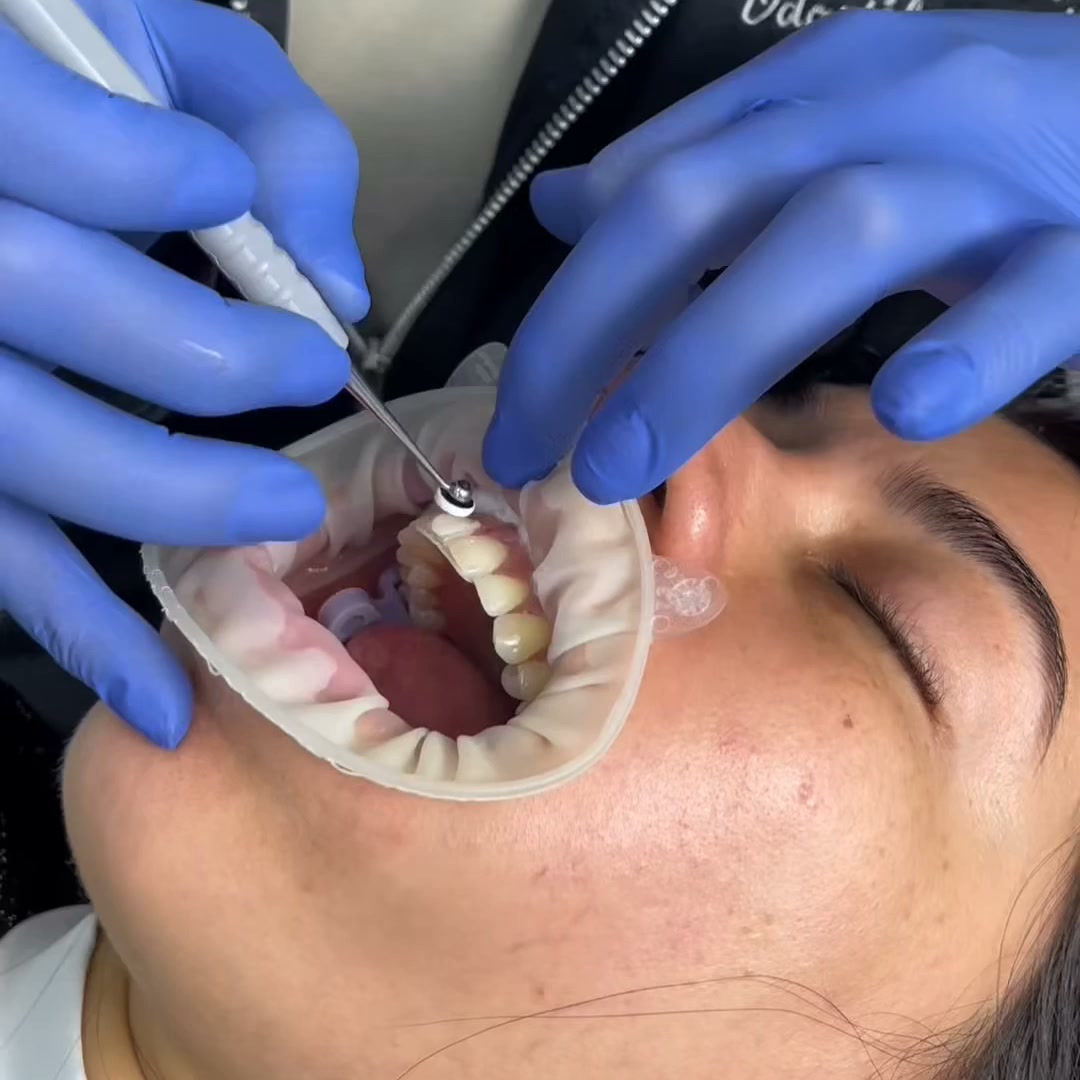 Sonrisas 360 Facebook ad: Pide tu cita de Valoración
