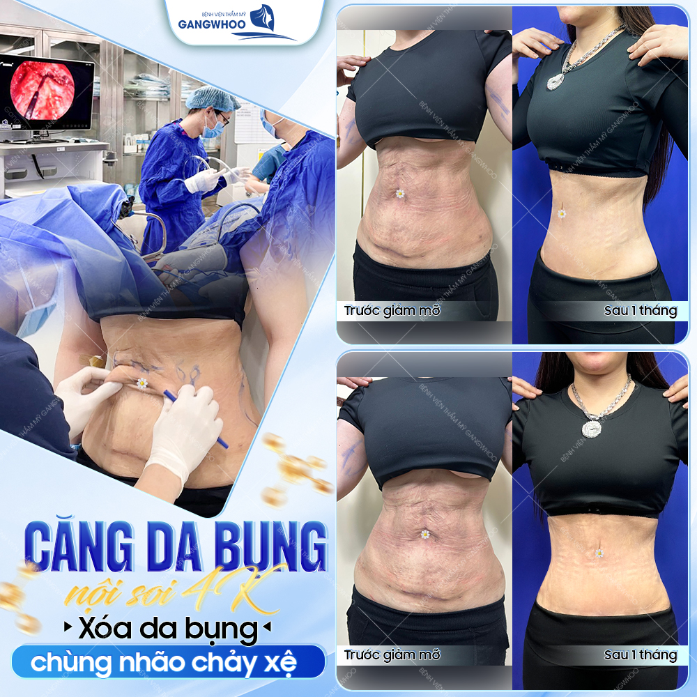 Bệnh viện thẩm mỹ Gangwhoo Facebook ad