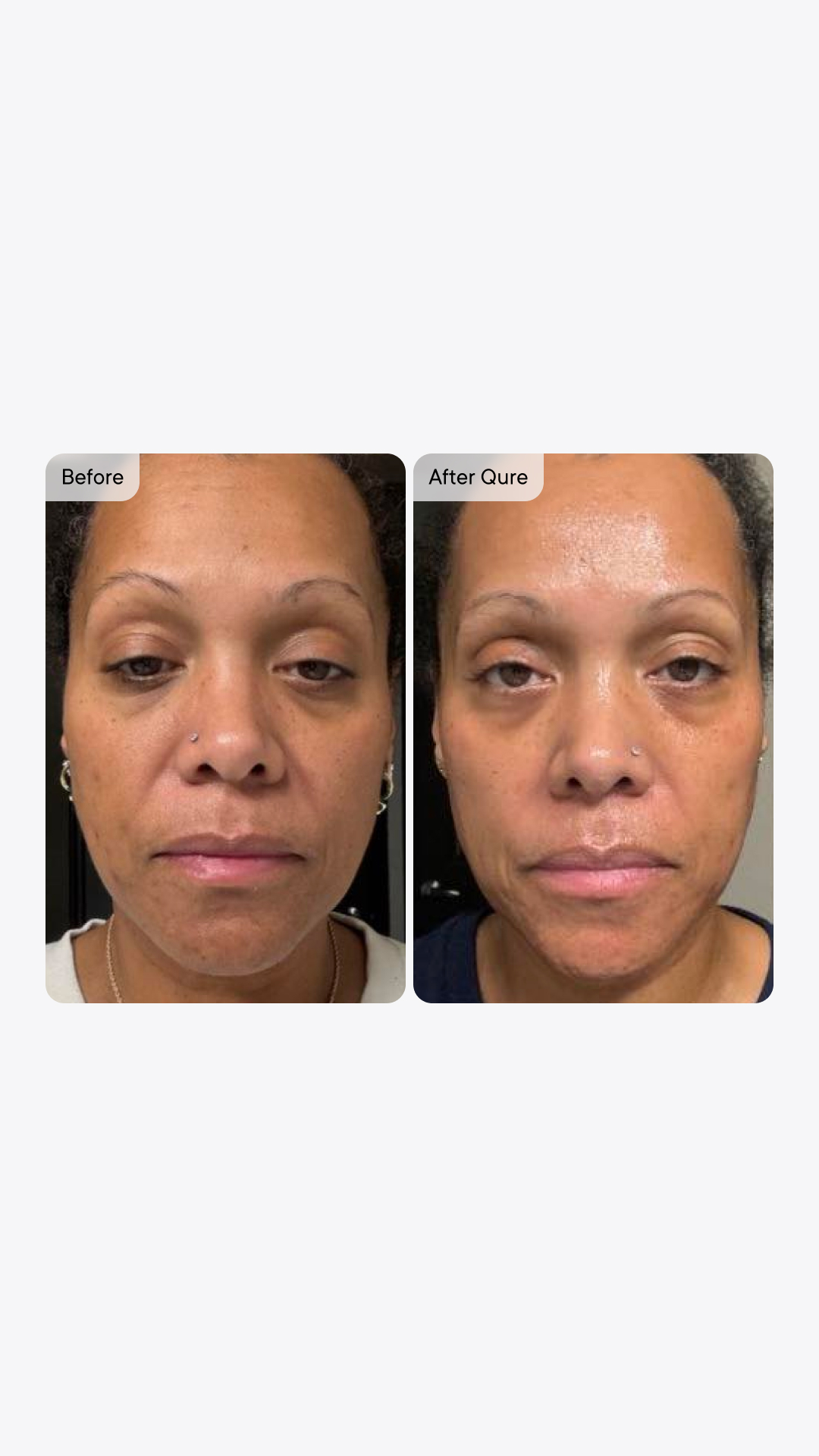 Qure Skincare Facebook ad