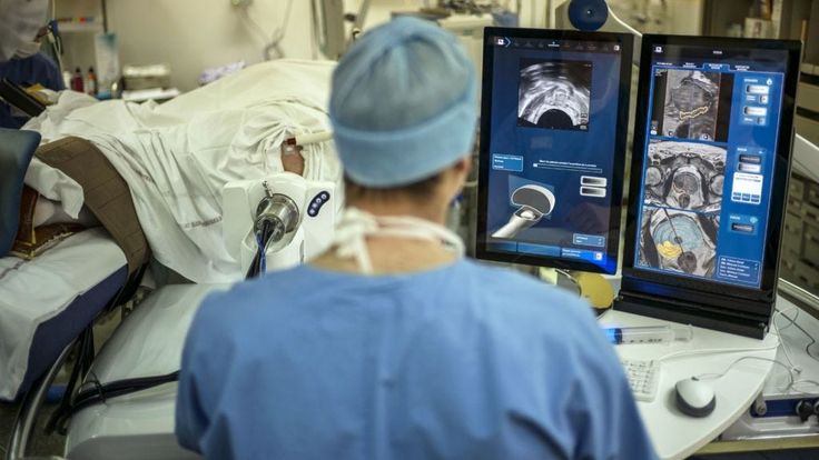 Dr. Andrew Ellis Facebook ad: Eliminate Your Prostate Problems in 4 Weeks