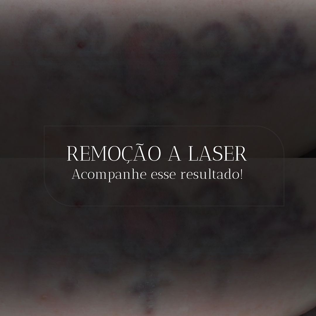 ionaraazevedostudio Facebook ad: É possível reescrever uma nova história Sim!