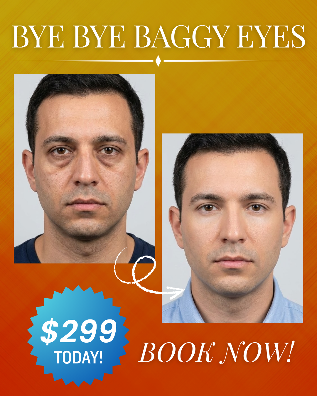 Highline Aesthetics Denver Facebook ad: Bye Bye Baggy Eyes for Only $299!