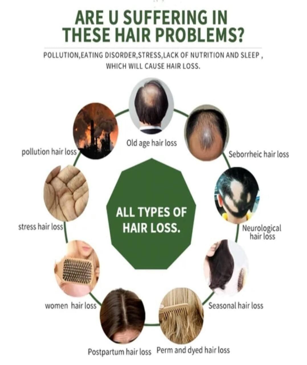 Naturalhairoil Facebook ad: GET 75% OFF + FREE HOME DELIVERY!