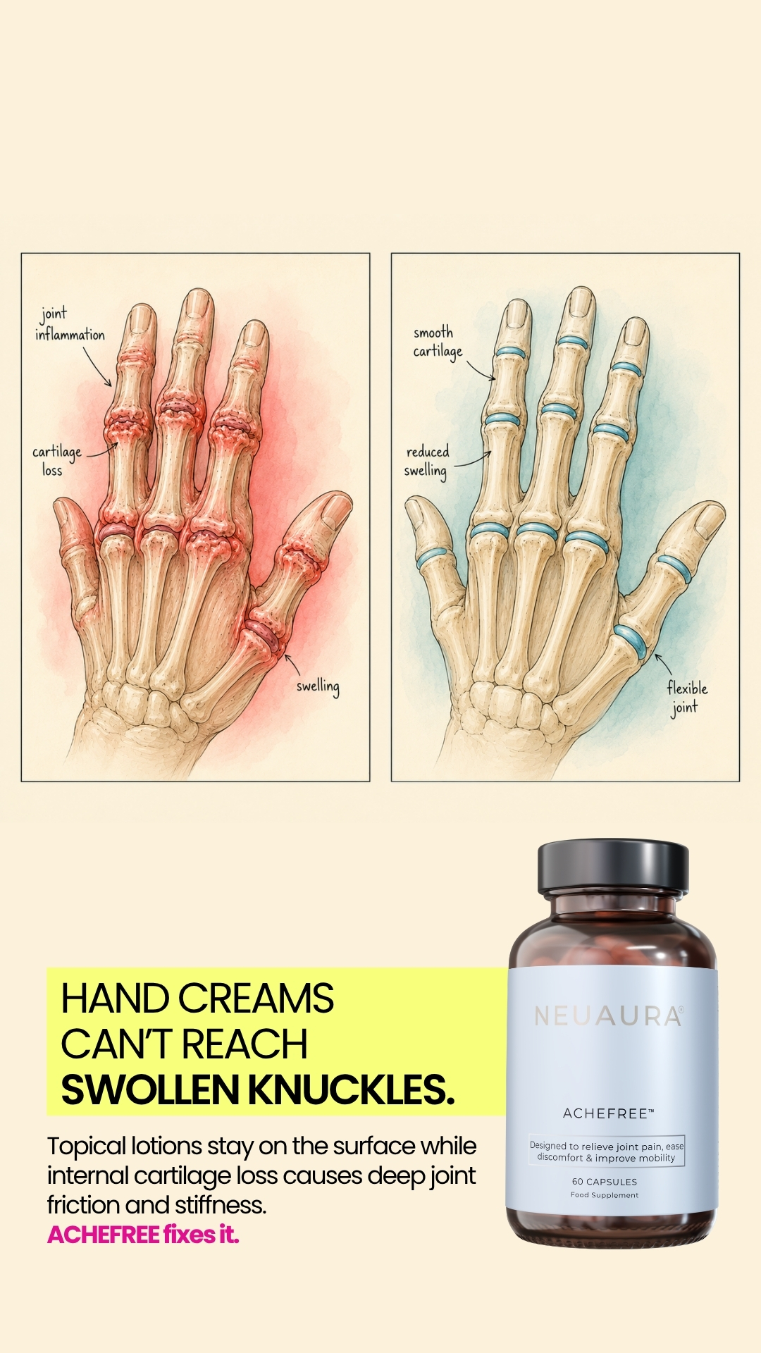 Neuaura Facebook ad