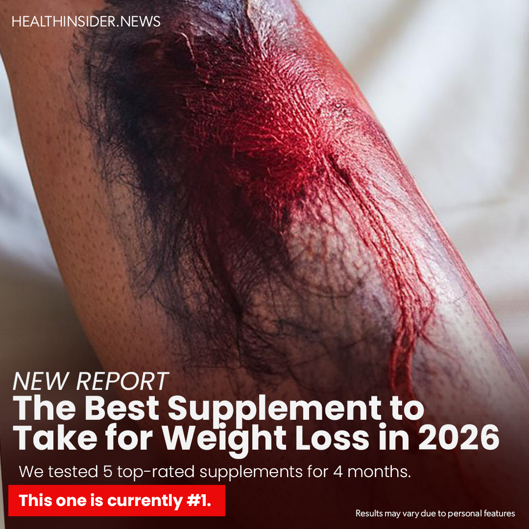 Health Insider Facebook ad