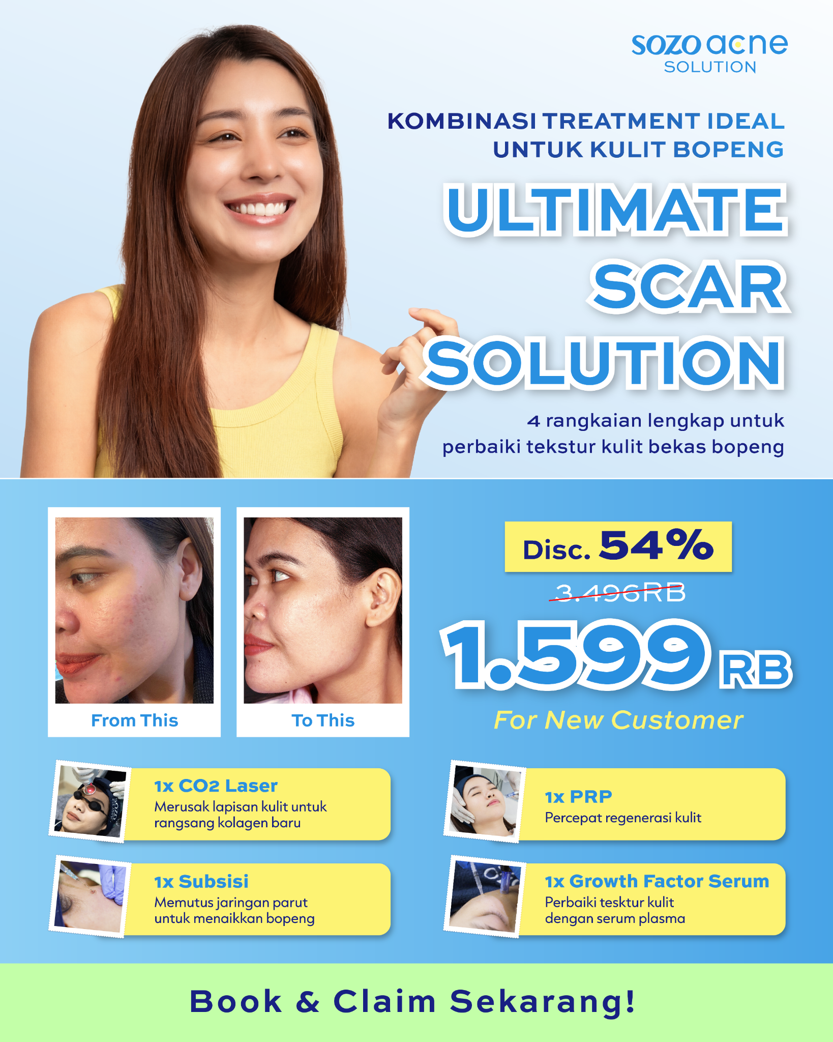 Sozo Acne Facebook ad