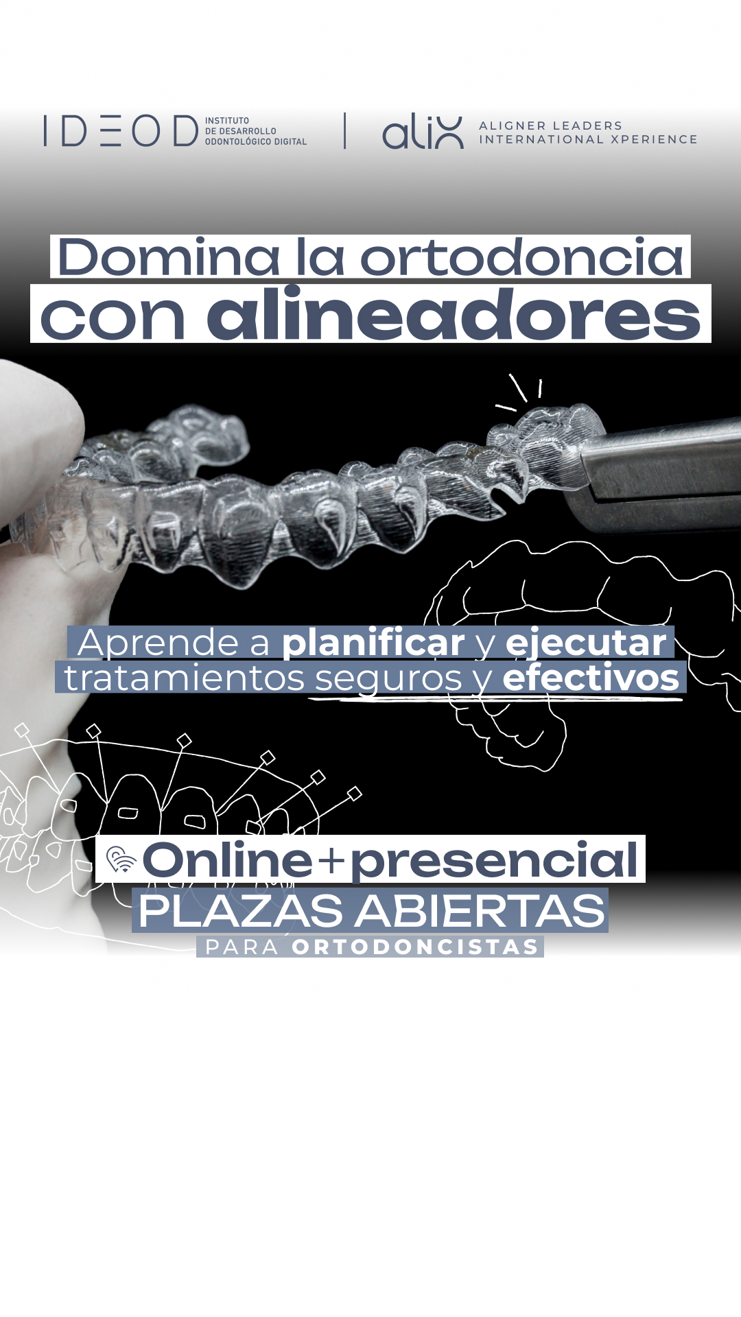 Instituto IDEOD Facebook ad: Domina los alineadores con +2.000 casos de experiencia