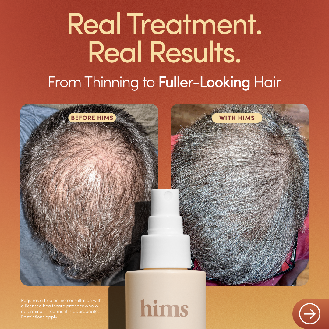 hims Facebook ad