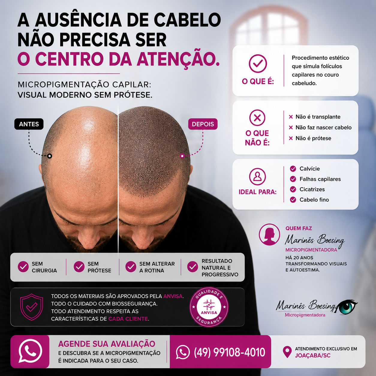 Marinês Boesing Micropigmentação Facebook ad