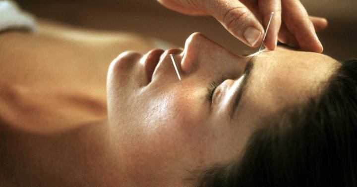 Ancient Approach Traditional Chinese Medicine Facebook ad
