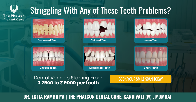 The Phalcon Dental Care Facebook ad from Jun 24, 2026