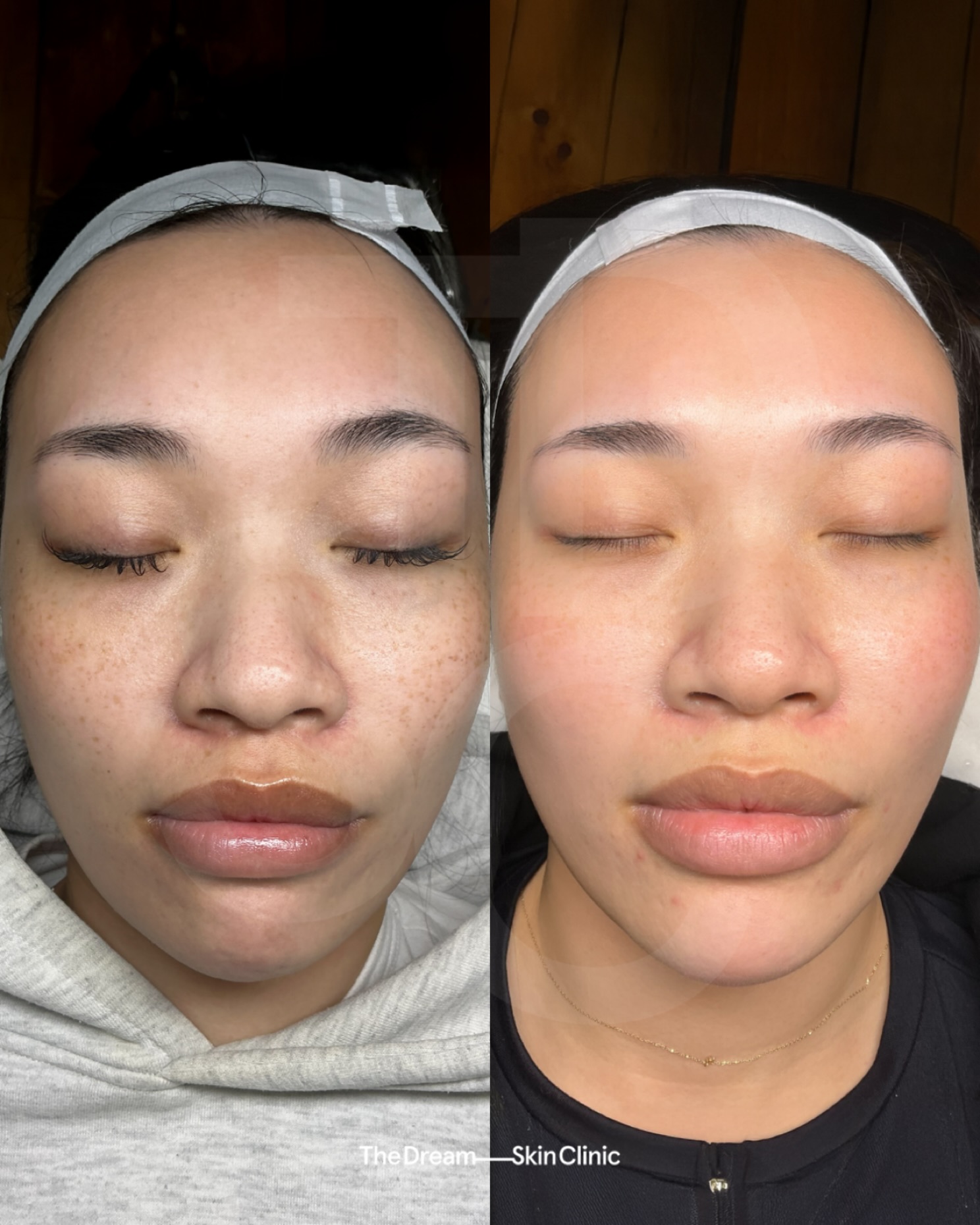 The Dream Skin Clinic Facebook ad: Reputation for Results