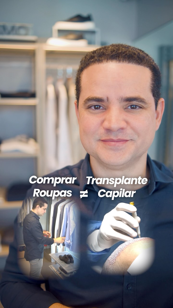 Dr Paulo Pessoa - Implante Capilar Facebook ad: Você não está comprando uma roupa que pode…